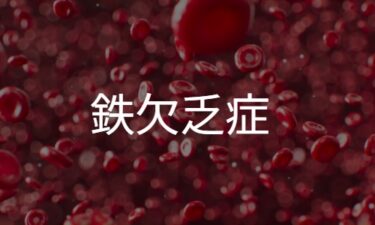 鉄欠乏症（Iron Deficiency）